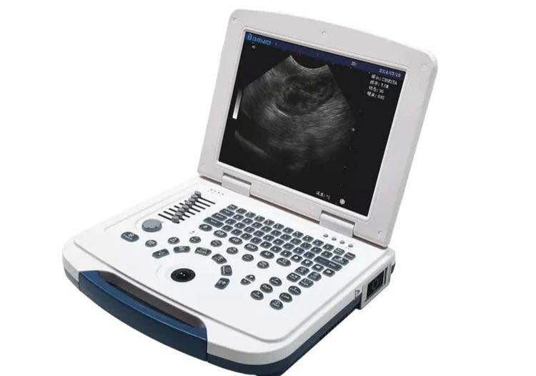 Portable Ultrasound supplied by UMES
